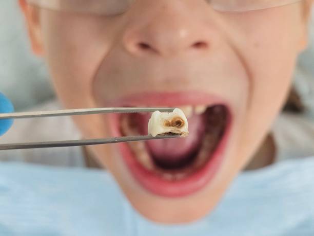 Best Emergency Pediatric Dentist  in Ester, AK